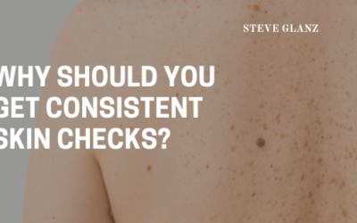 Why Should You Get Consistent Skin Checks?