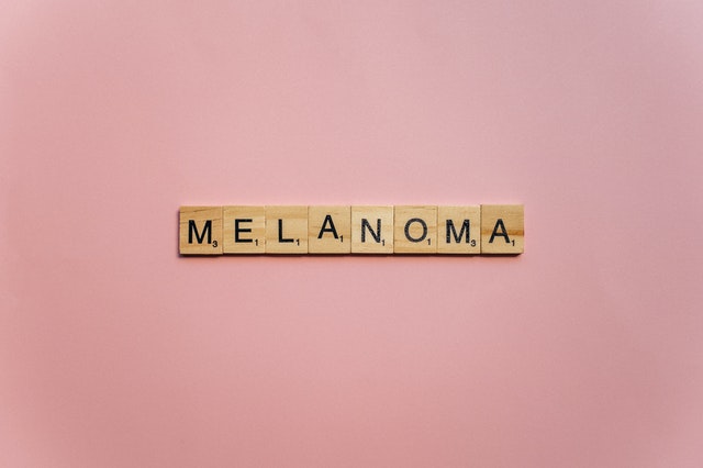 What Is Melanoma and How Can You Prevent It?